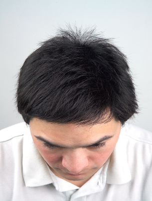 hairback006022.jpg